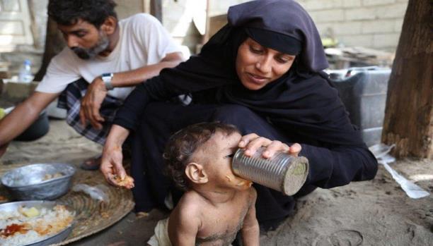 وكالات أممية تأمل اسهام الواردات بتجنيب اليمن أسوأ أزمة إنسانية بالعالم