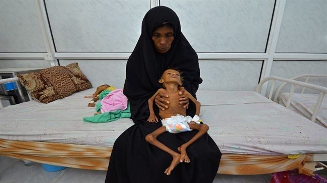 لجنة أممية تمهل العالم 3- 4 أشهر لإنقاذ ملايين اليمنين والصومال من المجاعة