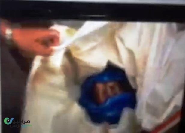 فيديو وصور مؤلمة لإصابات بالغة بوجه القشيبي بعد وصول جثته إلى صنعاء