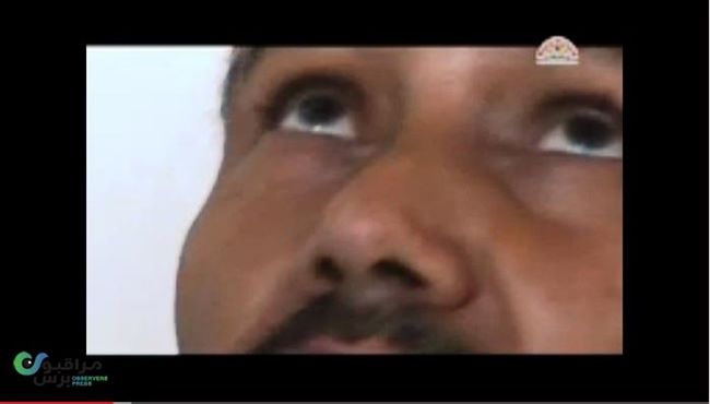 يمني يعود للحياة بعد اعدامه بـ4 طلقات بجسده(فيديو،صور،تفاصيل محيرة)