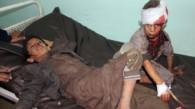 بي بي سي:الحوثيون يبثون فيديو"للحظات سبقت" قصف حافلة الأطفال بصعدة(فيديو)