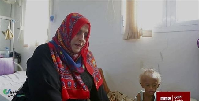 BBC تكشف عن قاتل اليمن الصامت وماوراء الدمار ومعاناة اليمنيين(فيديو)
