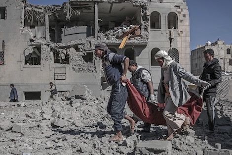 وكالة:منظمة انسانية تكشف عن ارتفاع عدد القتلى المدنيين في الحرب باليمن
