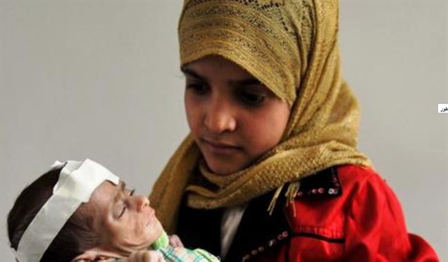 مالاتعرفه عن خطر الكابوس الذي ينهش أجساد وأحلام أطفال اليمن(صور)