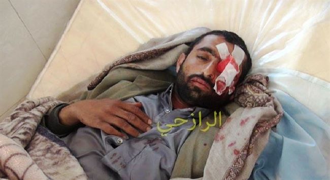 تفاصيل وعدد ضحايا الاشتباكات العنيفة الجارية بين الجيش والحوثيين بعمران(صور)