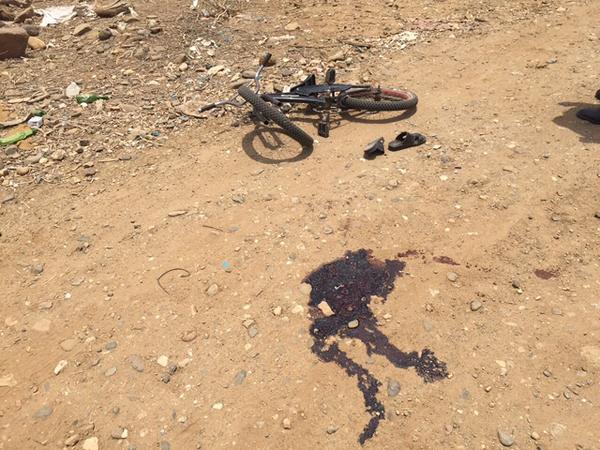 قذائف الحوثي تقتل طفل سعودي وتصيب شقيقه وأصدقائه أثناء لهوهم(صور)