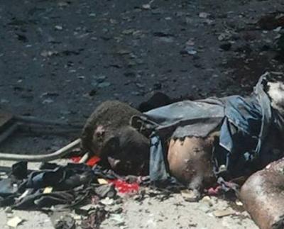 اصابة المحافظ ومدير الامن وقناة يمنية تبث مشاهد مؤلمة لقتلى التفجير بإب